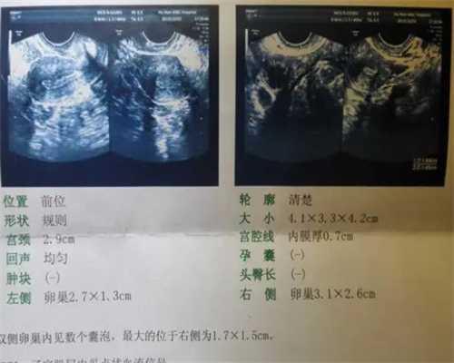 重庆供卵源中介 2024年重庆市试管婴儿排